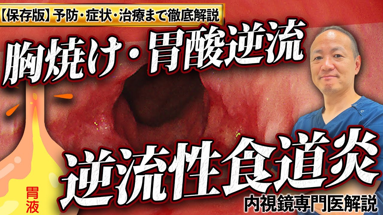 【保存版】逆流性食道炎とは？予防から治療まで内視鏡専門医が徹底解説【吉祥寺みどり内科・消化器クリニック】
