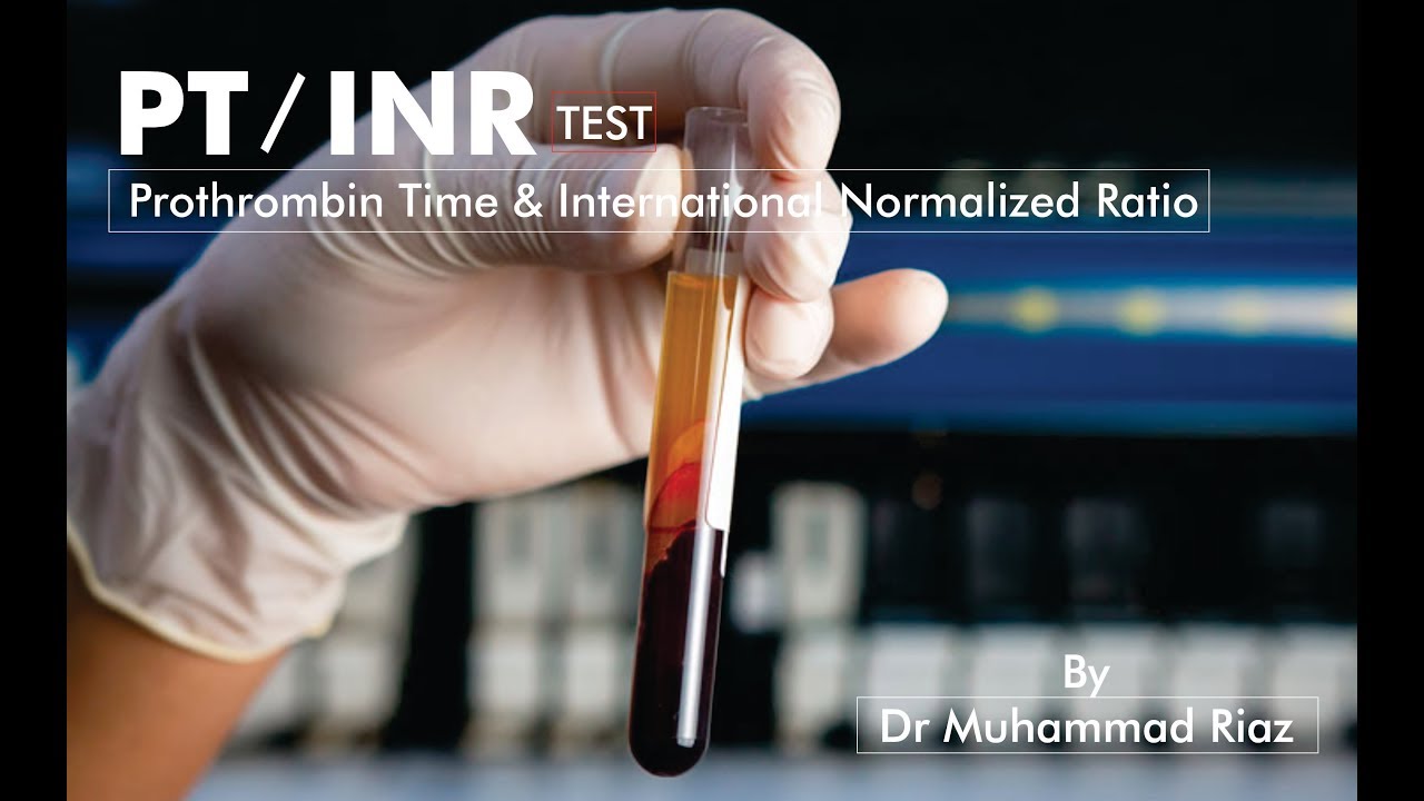 PT/INR Test || Prothrombin Time and International Normalized Ratio