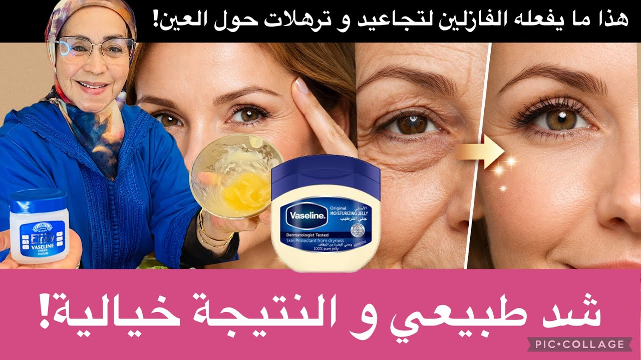 سر الفازلين للتخلص من تجاعيد وانتفاخات وترهلات الجفن حول العين | الخلطة الأصلية