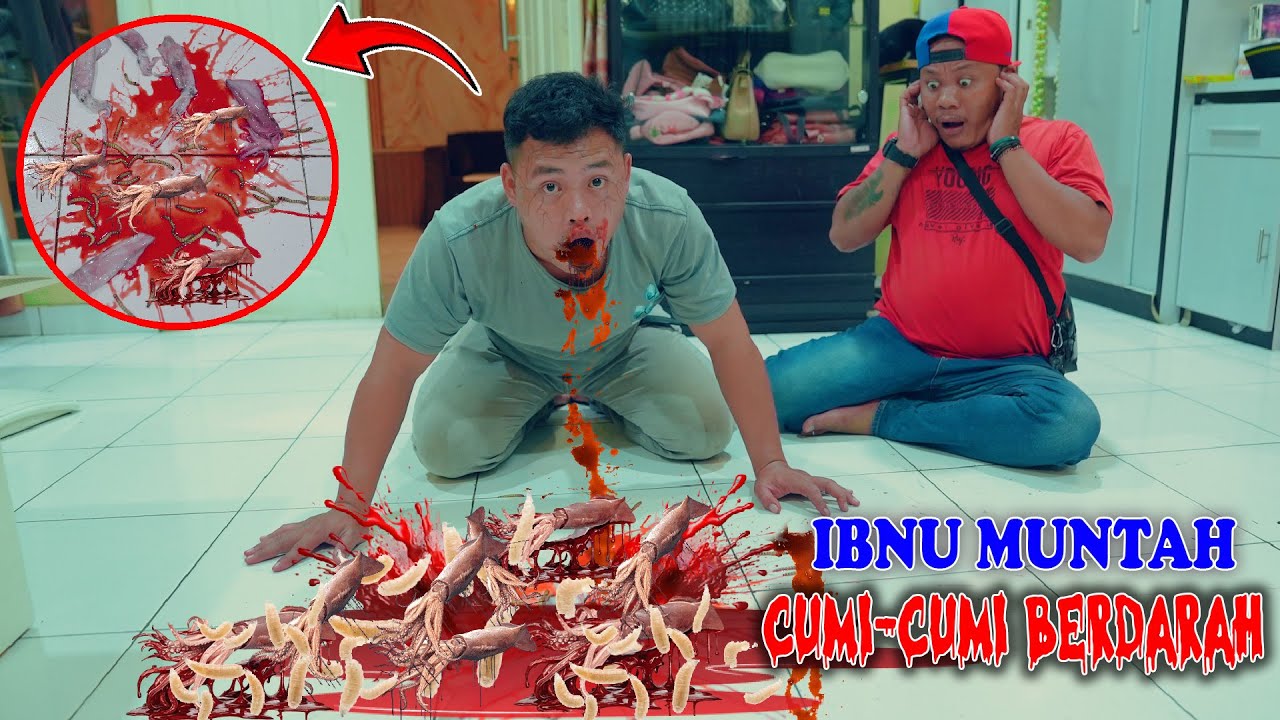 Ibnu Makan Cumi - Cumi Berujung Muntah Darah & Belatung