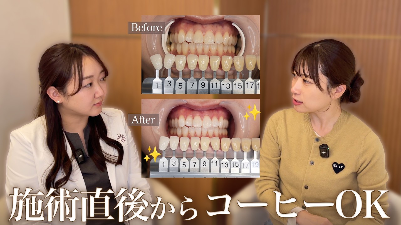 食事制限なし？矯正中でもOK？話題のトランセントホワイトニングを解説