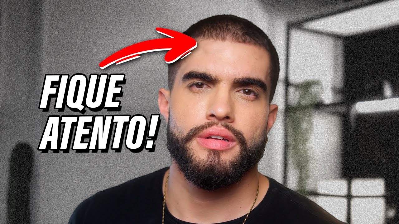 Sinais que Você vai FICAR CALVO