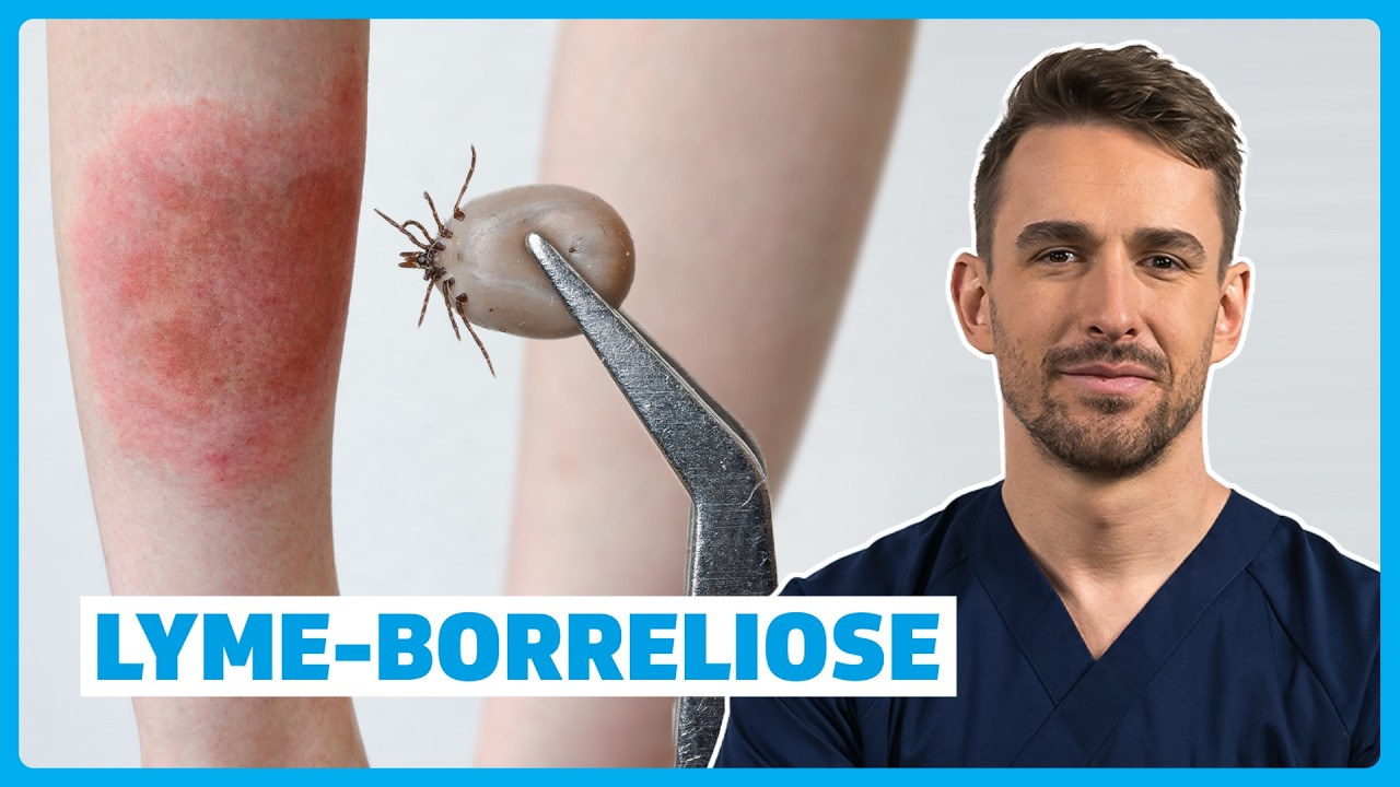 Lyme-Borreliose verstehen: Ursachen, Symptome, Diagnose & Therapie | DocTommy
