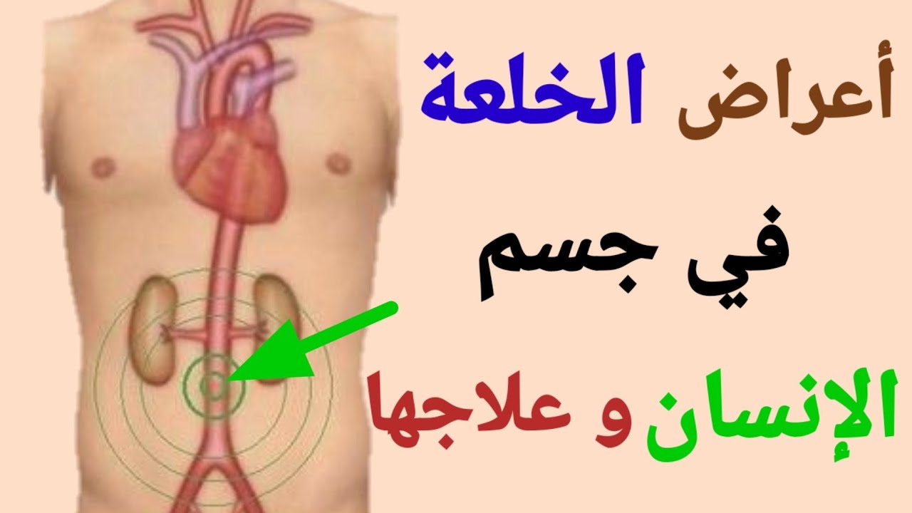 اعراض الخلعة الشديدة وعلاجها / بومزوي