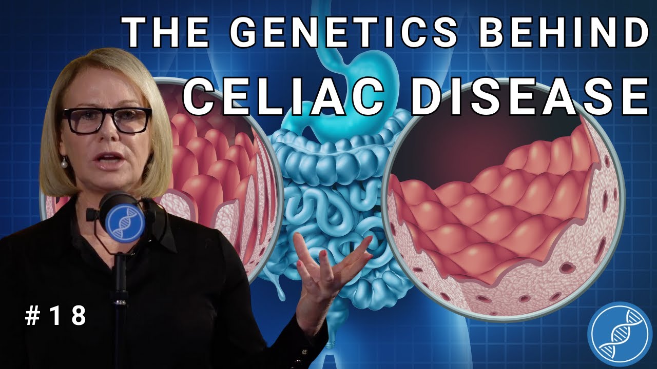 Understanding the Genetics of Celiac Disease