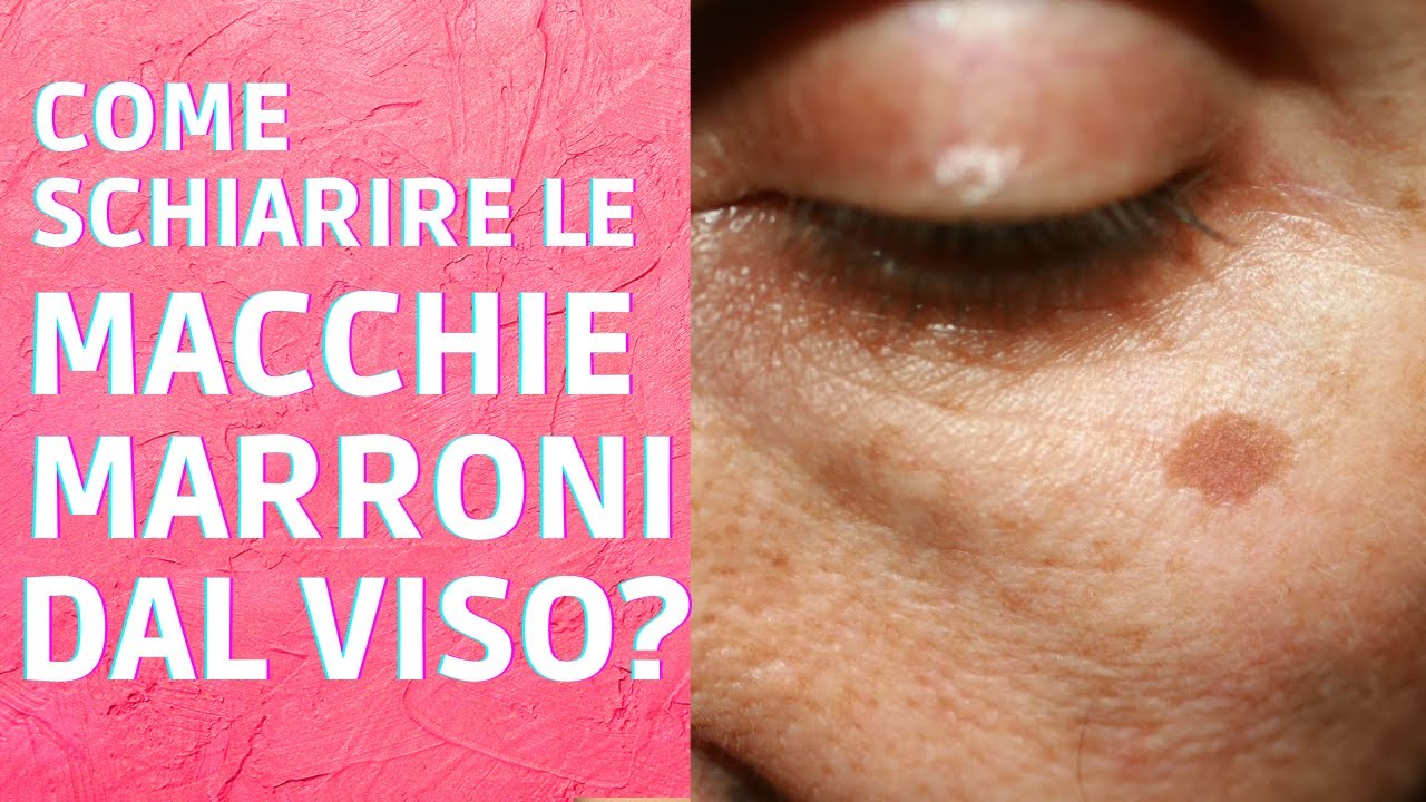 Come schiarire le macchie marroni dal viso? Centro Estetico Beauty Time Genova