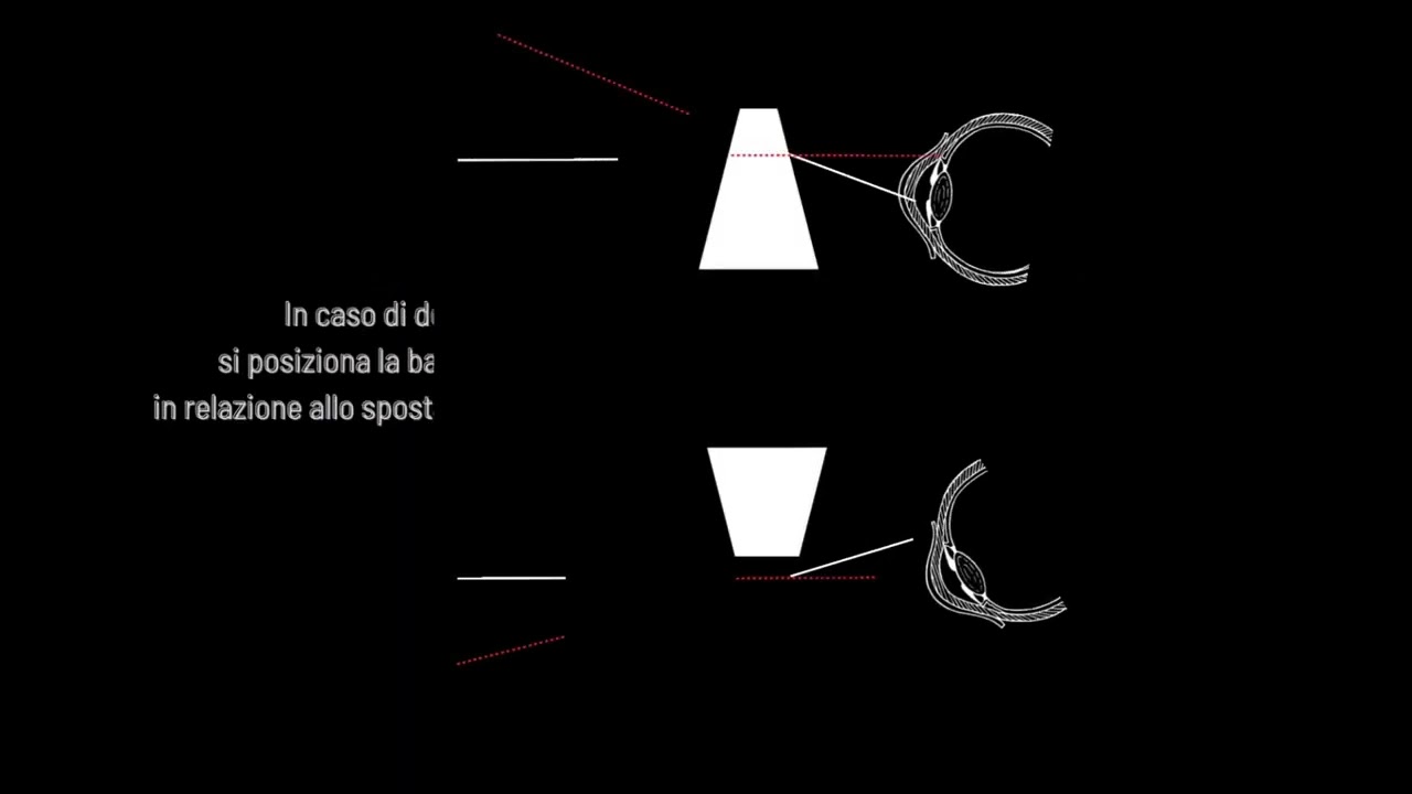 Le lenti prismatiche - ottica Napoli dieci decimi