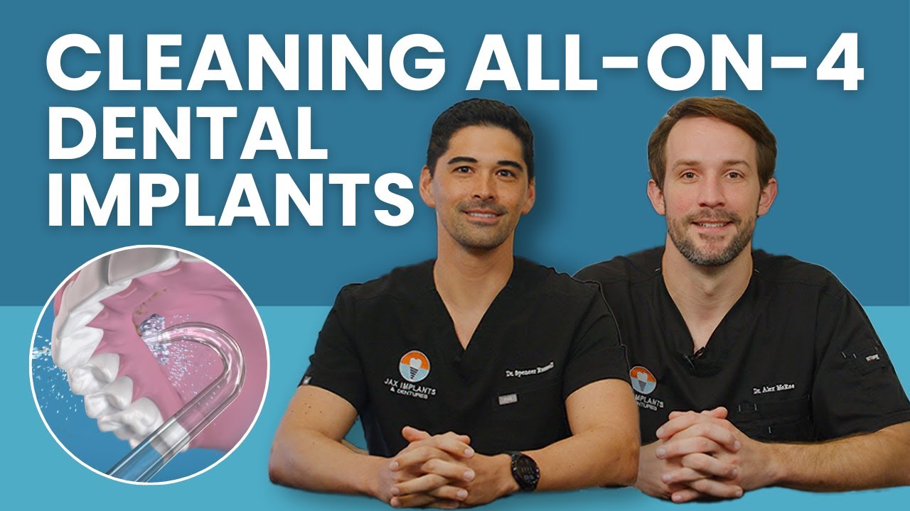 How to Clean Your All-On-4 Dental Implant Teeth - Jax Implants and Dentures - FAQs