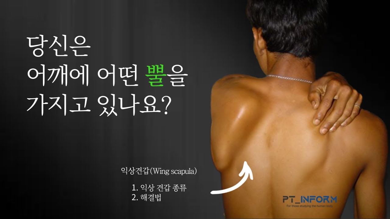 날개뼈가 뜨면 무조건 전거근(앞톱니근,serratus anterior) 운동을 해야한다? 반쪽 전문가가 되시면 안되옵니다..!!