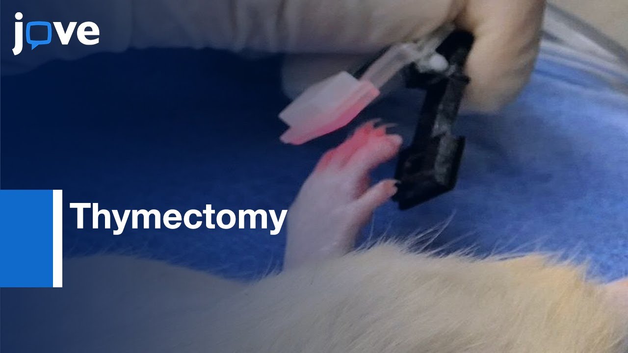 Complete Thymectomy with Non-invasive Endotracheal Intubation | Protocol Preview