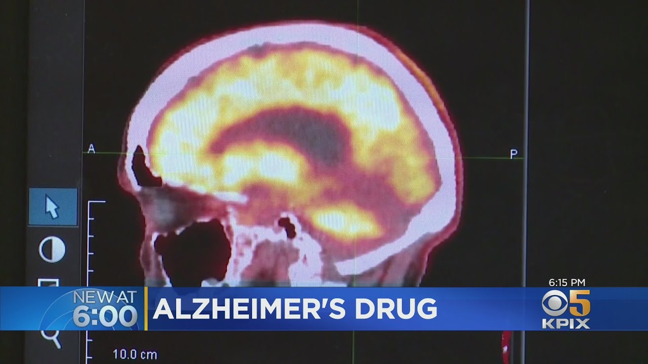 FDA Approves First Drug That Slows Cognitive Decline In Alzheimer's Patients