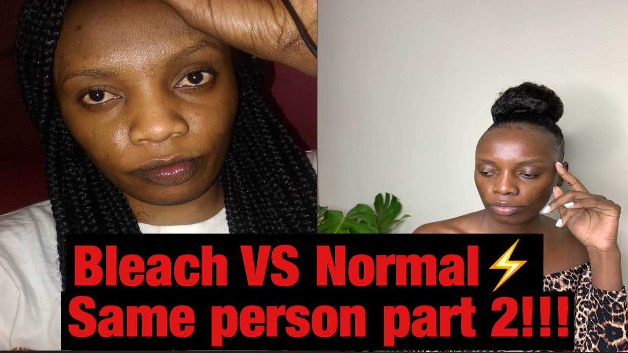 How To get  dark skin back after bleaching/I bleached my skin!!! Part2
