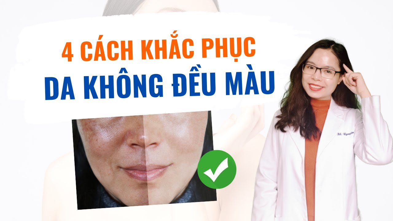 4 cách làm da trắng sáng tại nhà - da không đều màu phải làm sao  - Bác sĩ Nguyên