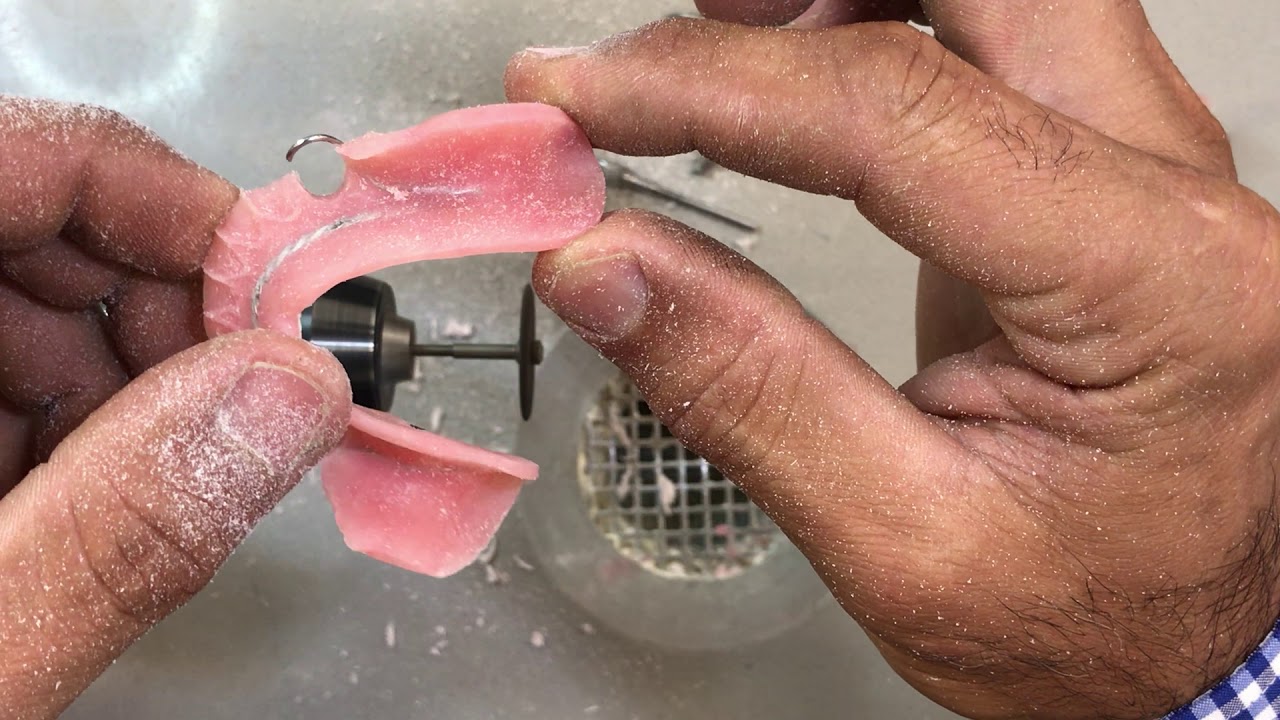 Trimming and Polishing Acrylic Partial #3