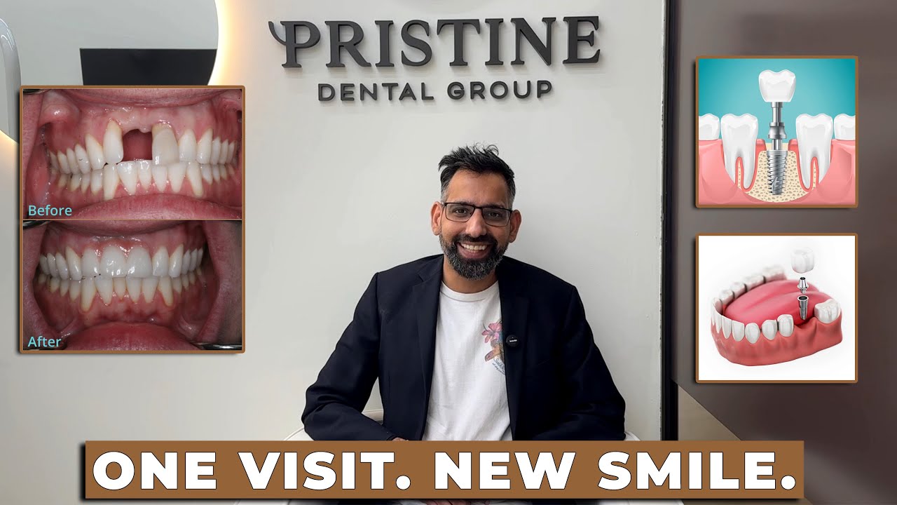Dental Implants in London: Why Amar Chose Pristine Dental Group