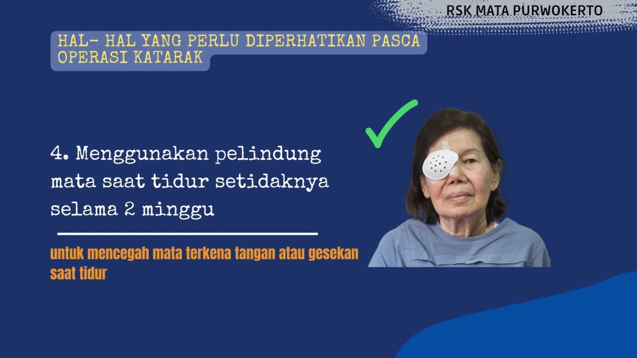 Perawatan Mata Pasca Operasi Katarak