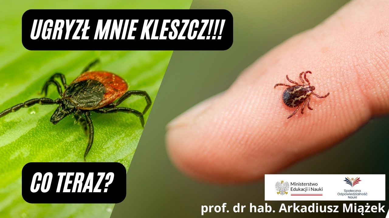 Jak usunąć kleszcza? Diagnostyka boreliozy, jak leczyć boreliozę? Czy borelioza jest uleczalna?
