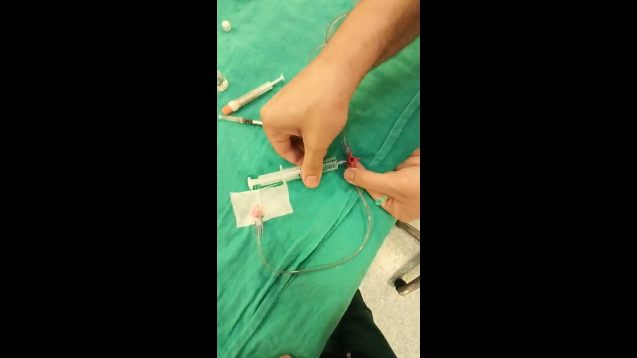 Arter Transducer Setinden Kan Gazı Alma Pratiği