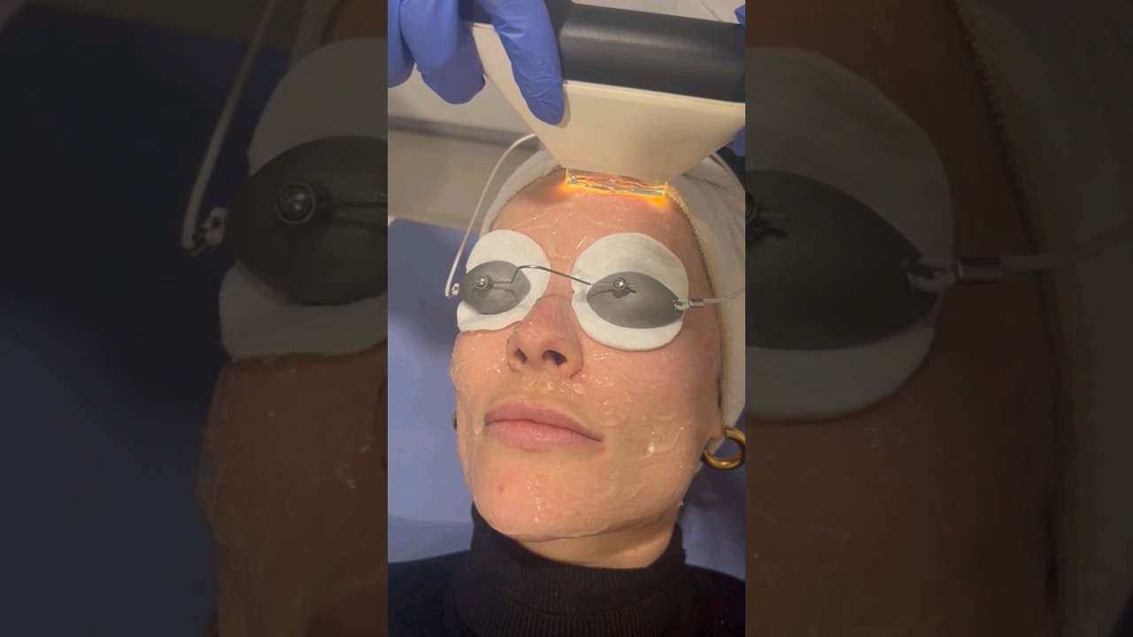 Conoce el tratamiento IPL para manchas y rejuvenecimiento facial | ilahy clínicas