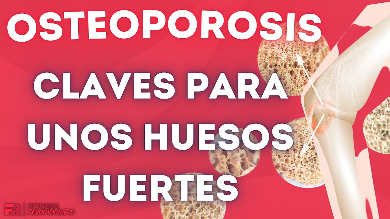 Osteoporosis: Claves para unos Huesos Fuertes