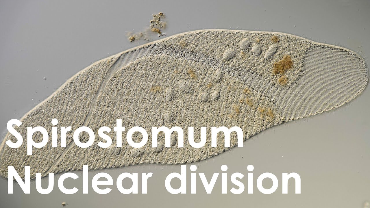 Spirostomum - Nuclear division of the macronucleus