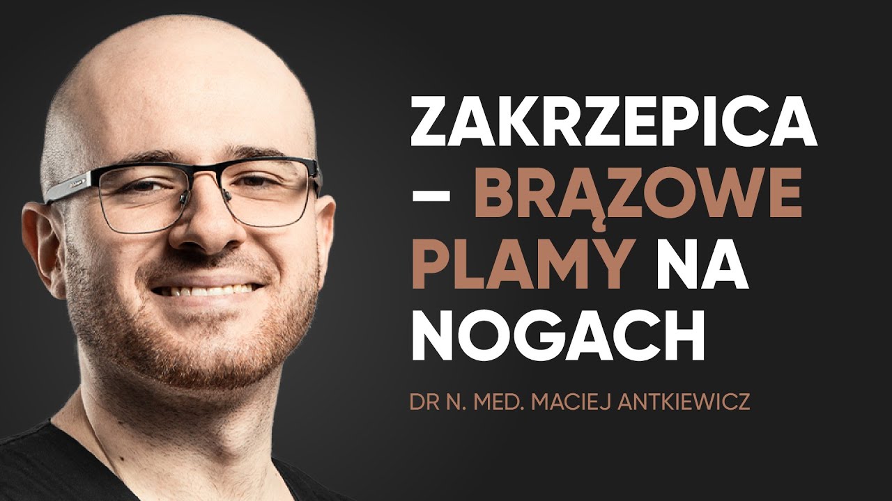 Czy brązowe plamy na nogach to objaw zakrzepicy?