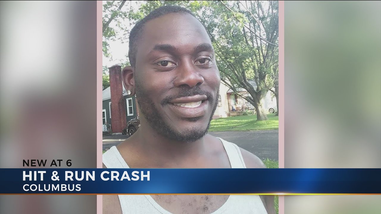 Pedestrian suffers brain trauma after being hit by car