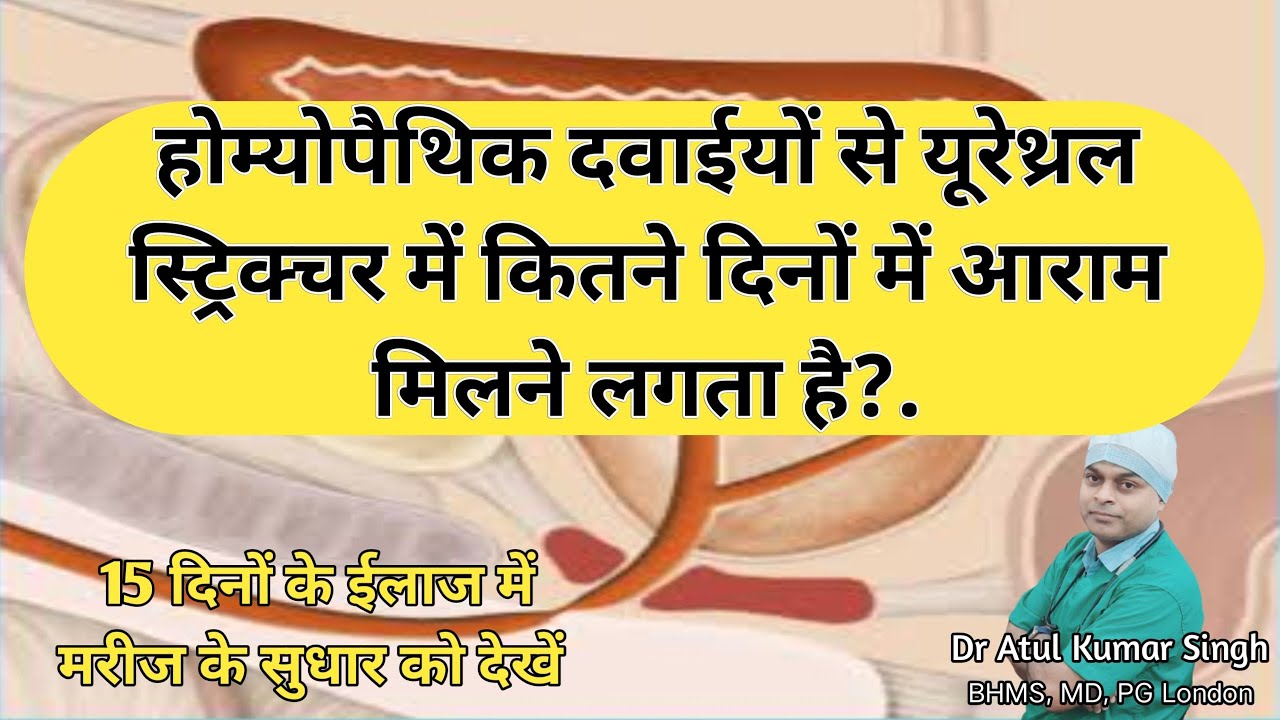 Urethral stricture | How much time homeopathic medicines take to give relief | How to maintain flow