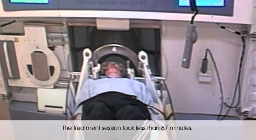 MIBS: Gamma Knife Radiosurgery for Parkinson Desease