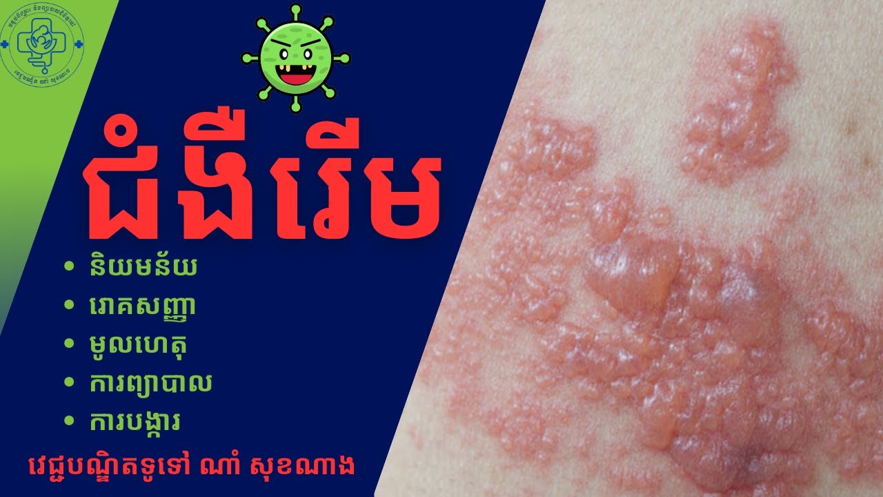 ជំងឺរើម ដោយវេជ្ជបណ្ឌិត ណាំ សុខណាង