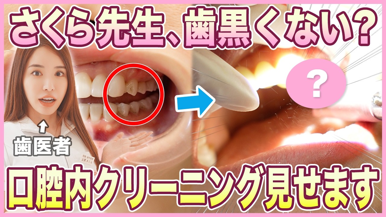 さくら先生の着色をクリーニング！【歯医者｜エアフロー｜着色｜黒ずみ】