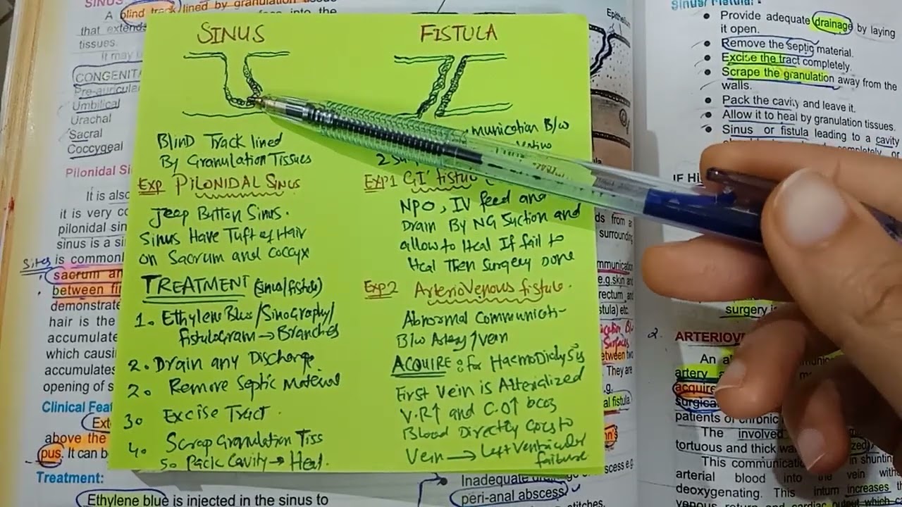 DIFFERENCE BETWEEN SINUS AND FISTULA general surgery