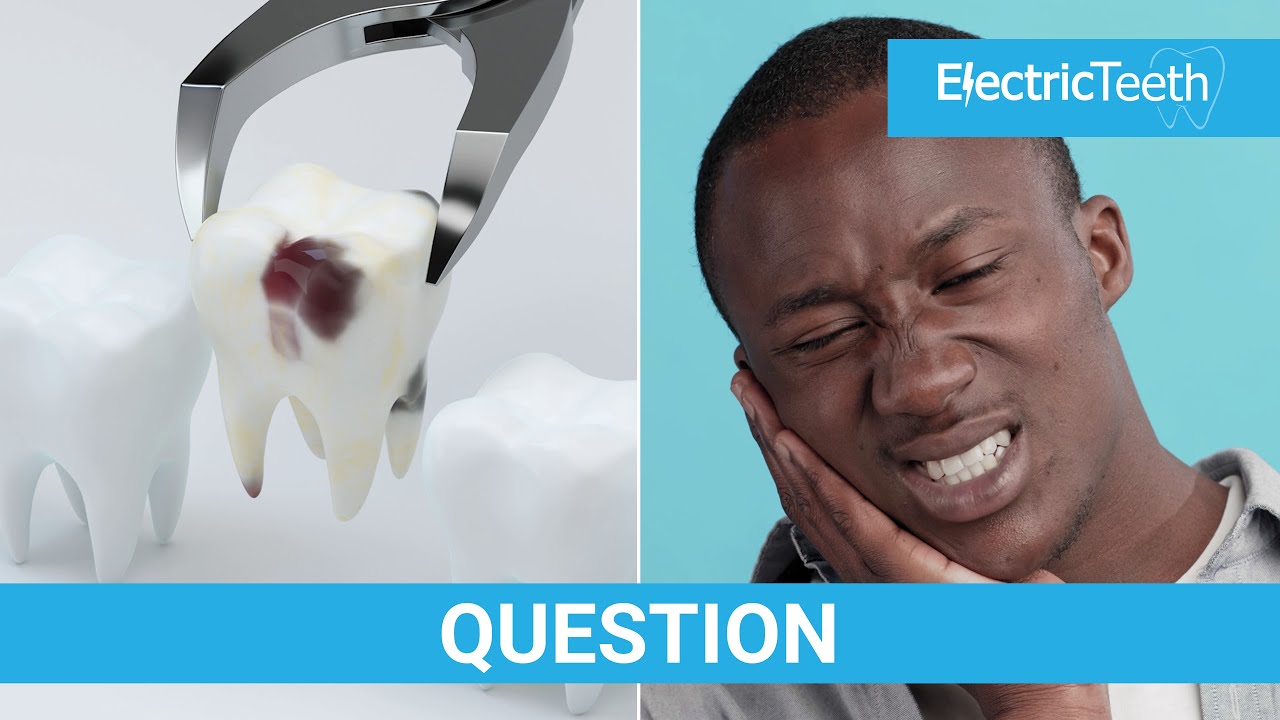 How painful is a tooth extraction?