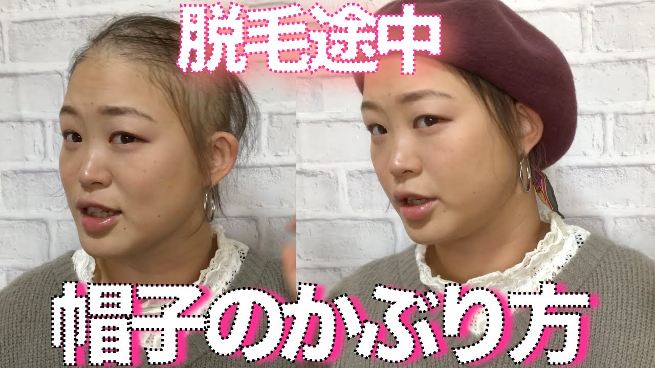 横から見られても大丈夫！【脱毛途中】私なりの帽子のかぶり方