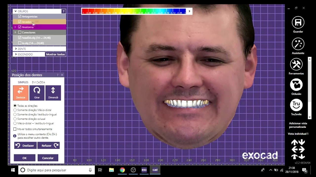 Dental Designer | Alexandre Matias EXOCAD + Scan de face Iphone XS Max+ Enceramento Diagn&oacute;stico