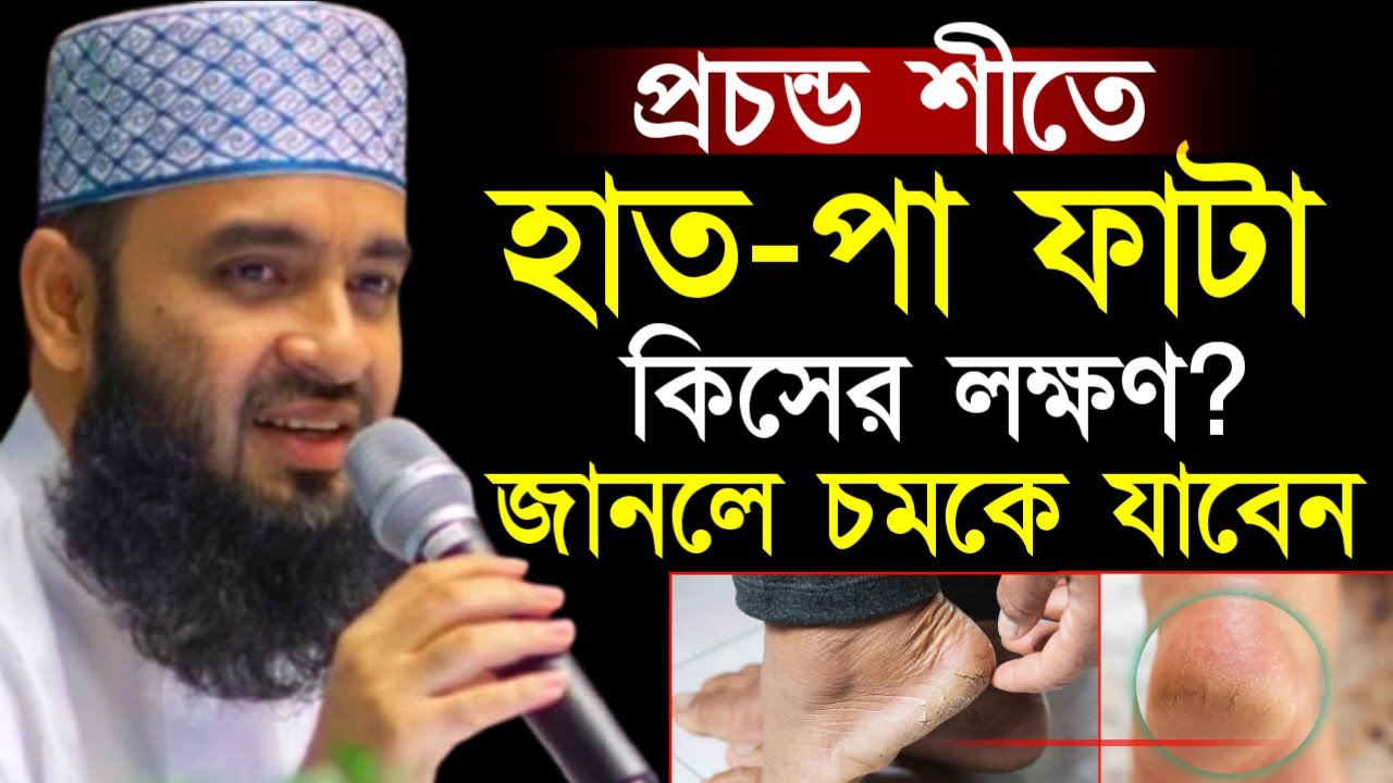 ✔🟢শীত কালে হাত পা ফাটা কিসের লক্ষণ দেখুন জানলে অবাক হয়ে যাবেন=মিজানুর রহমান আজহারী/তাং=Feb 5, 2026