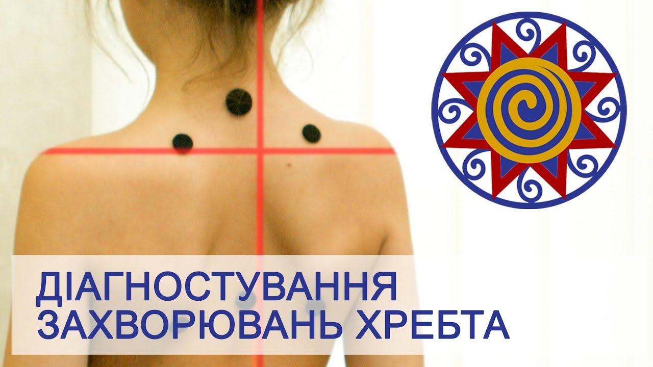 Диагностика заболеваний позвоночника методом фотометрии. Клиника 