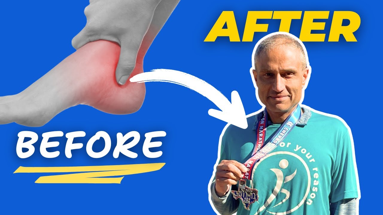 From Injury to Marathon: Overcoming Posterior Tibial Tendonitis