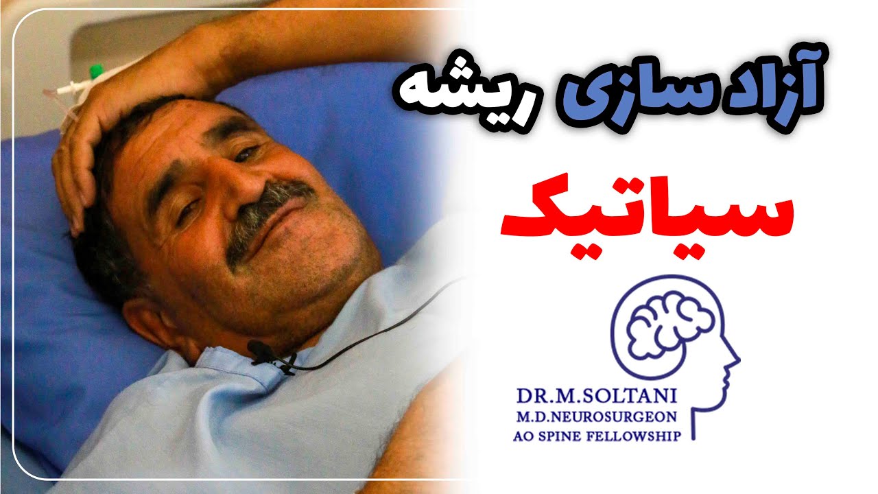 آزادسازی ریشه سیاتیک