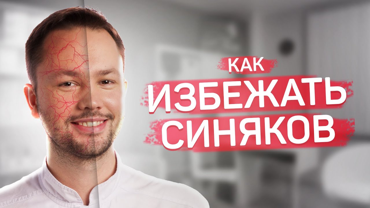 Синяки после уколов красоты.