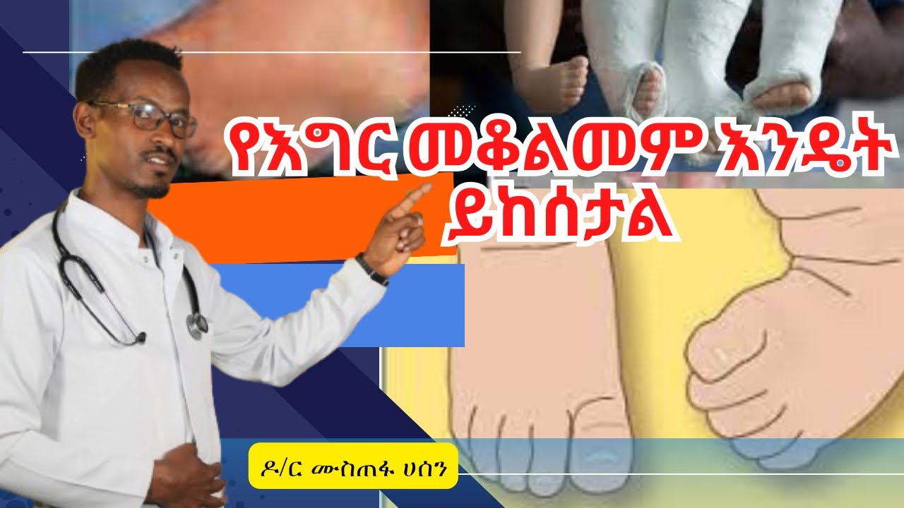Ethiopia - የእግር መቆልመም እንዴት ይከሰታል?