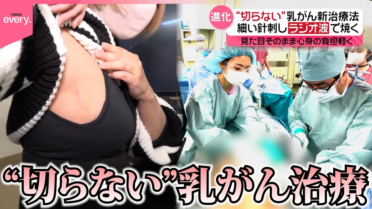 【乳がん】治療後も「自分らしく生きる」乳がんケア最前線 …“切らない”新治療や3Dスキャナーを使う人工乳房も『every.特集』