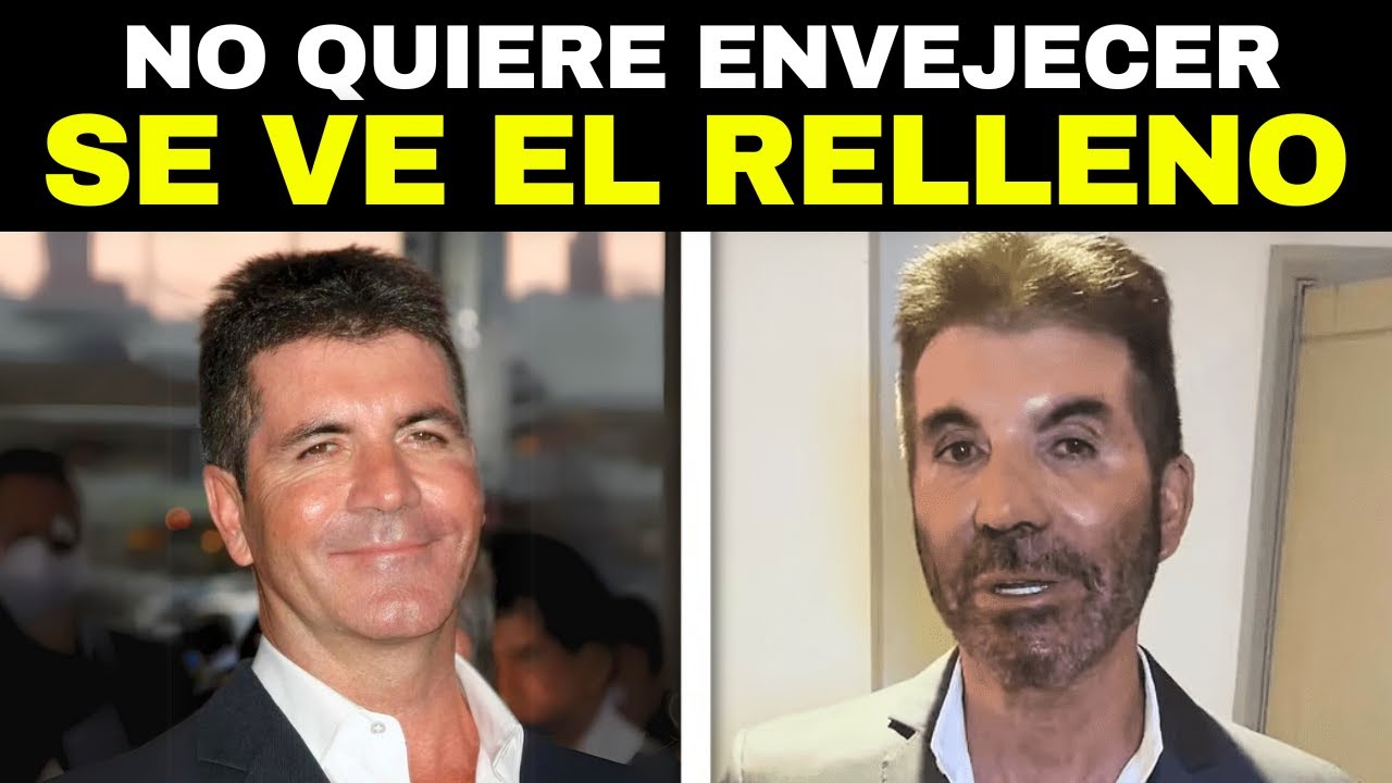 20 FAMOSOS Antes y Después de la Cirugía Plástica
