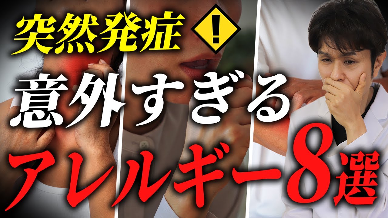 【要注意】突然発症？意外過ぎるアレルギーを皮膚科専門医が解説！