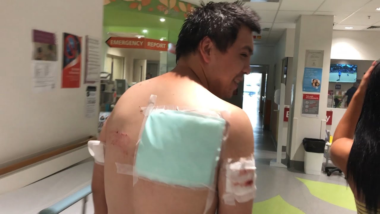 he needed 20 STITCHES!!