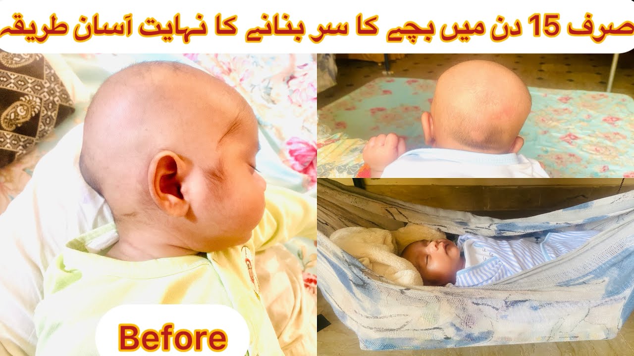 Sirf 15 Din me Bache ka Ser Bnane ka Nahayet Asan Tareeka