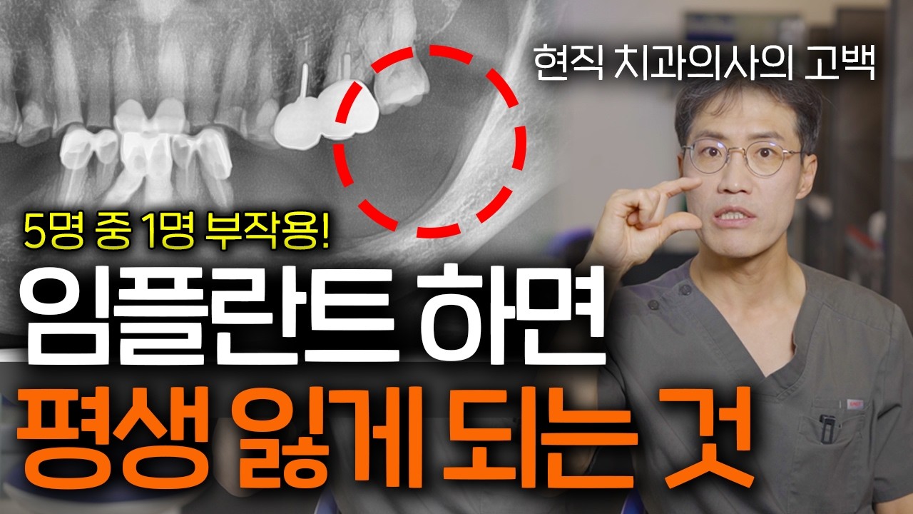 '임플란트' 치과에서 권해도 무조건 신중하게 결정 해야 하는 이유 l 임플란트의 치명적 부작용 3가지