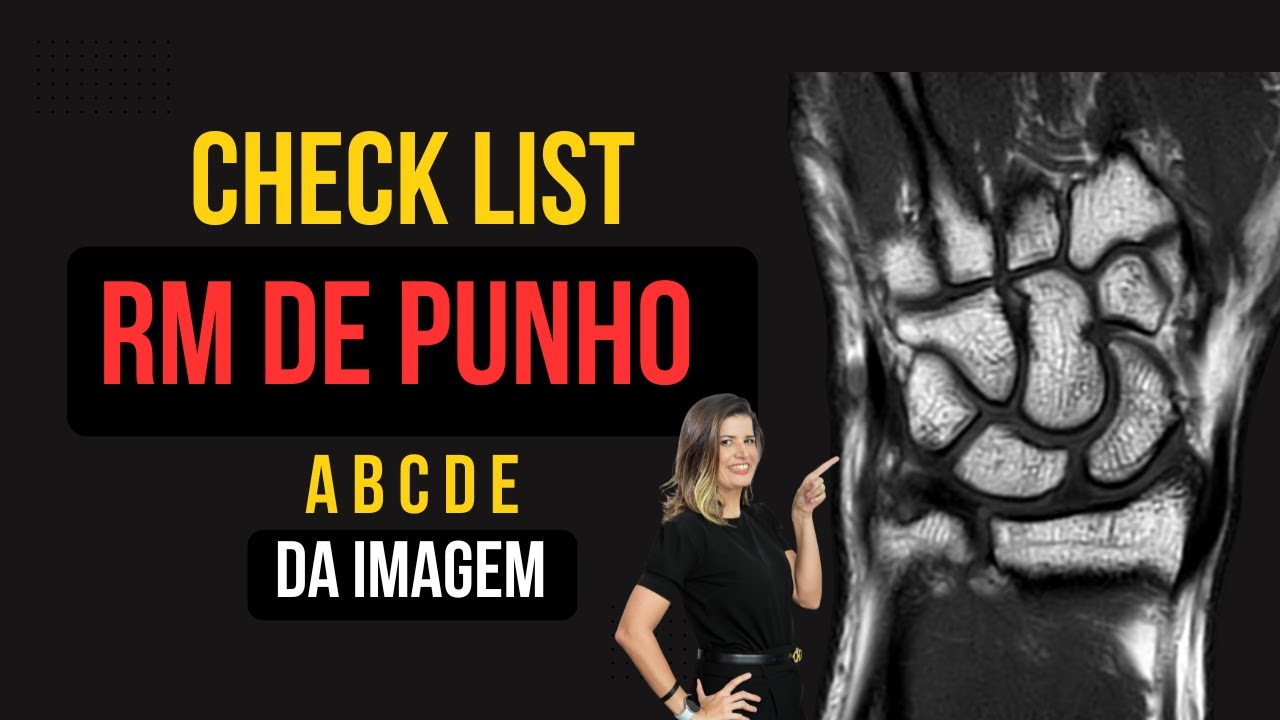 RM PUNHO - O QUE VOCÊ DEVE SABER ANALISAR!