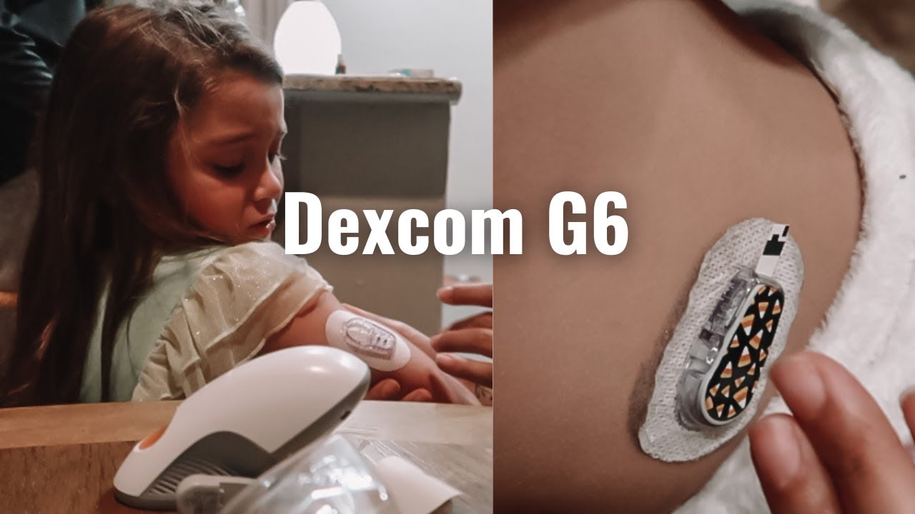 Trying to restart a dexcom sensor & Site change | T1D Twins