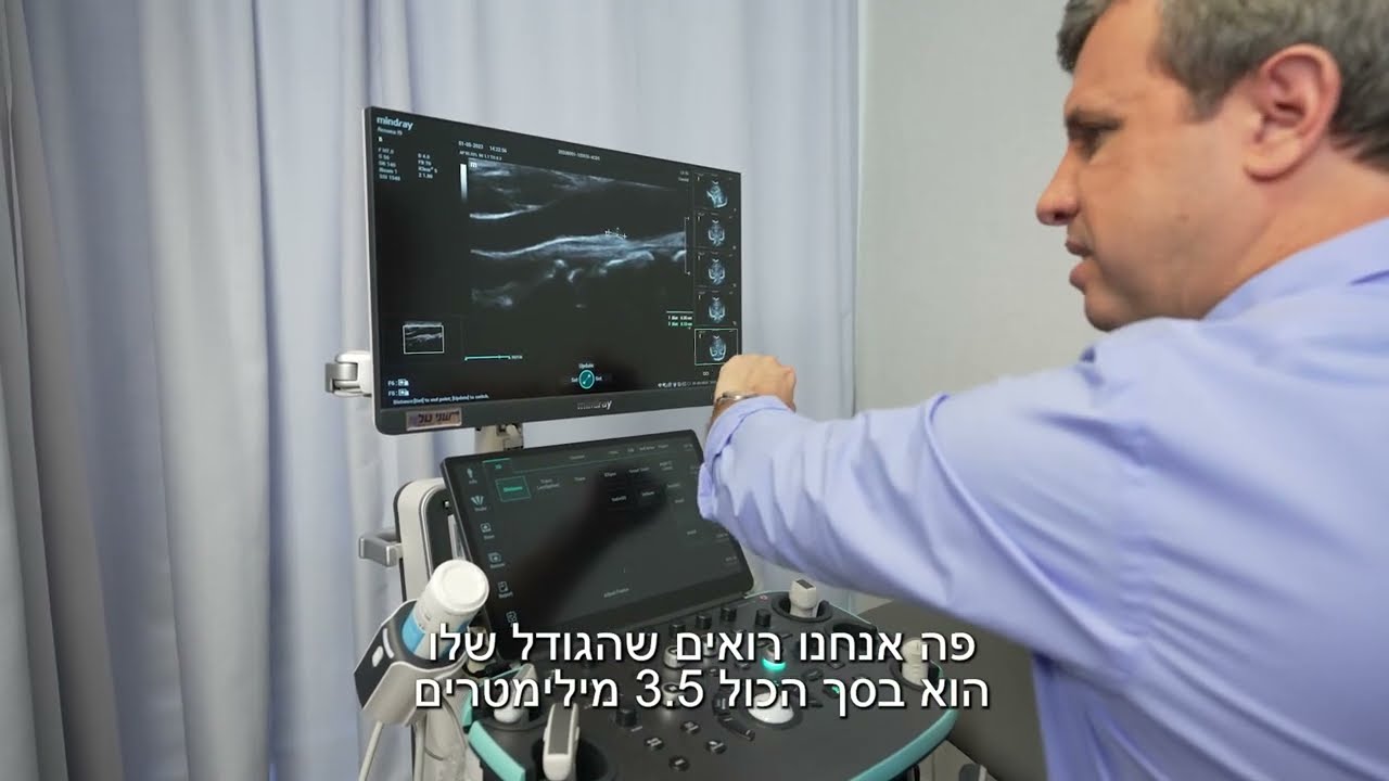 דופלר עורקי צוואר